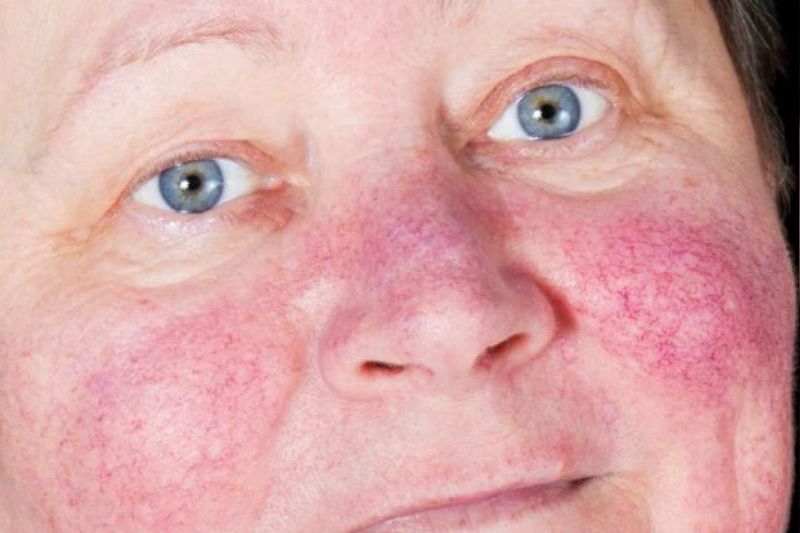 Ngủ Máy Lạnh Có Trắng Không? Bí Kíp Dưỡng Trắng Hiệu Quả 2025 giảm đề kháng da