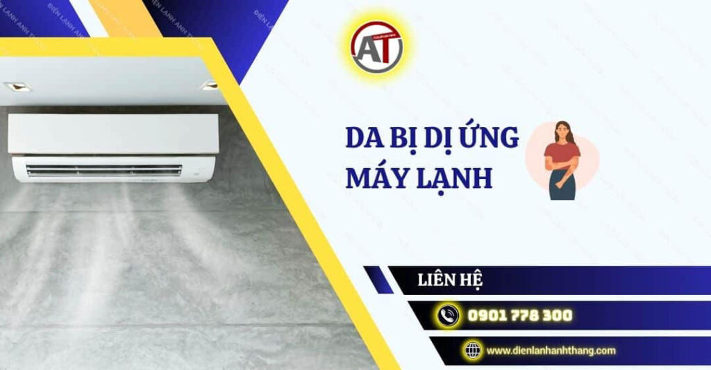 Nguyên Nhân Da Bị Dị Ứng Máy Lạnh - Biểu Hiện Và Cách Xử Lý 2025 da bị dị ứng máy lạnh Điện lạnh Anh Thắng