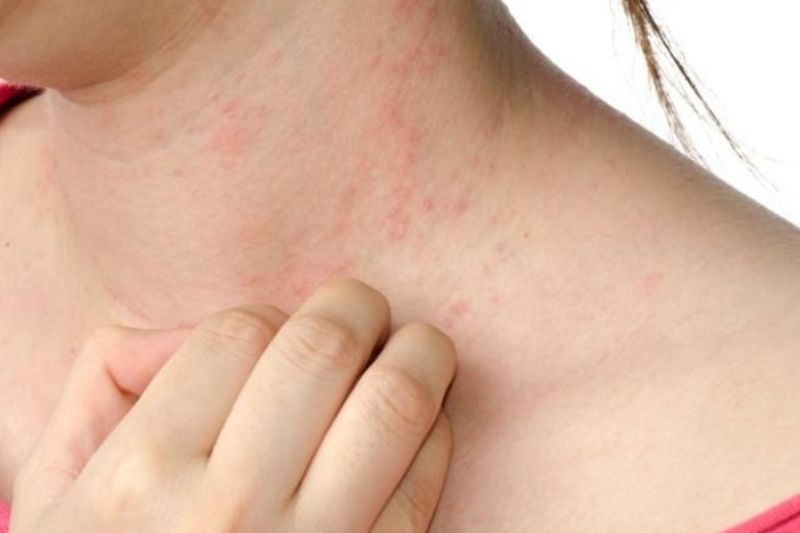 da dị ứng máy lạnh